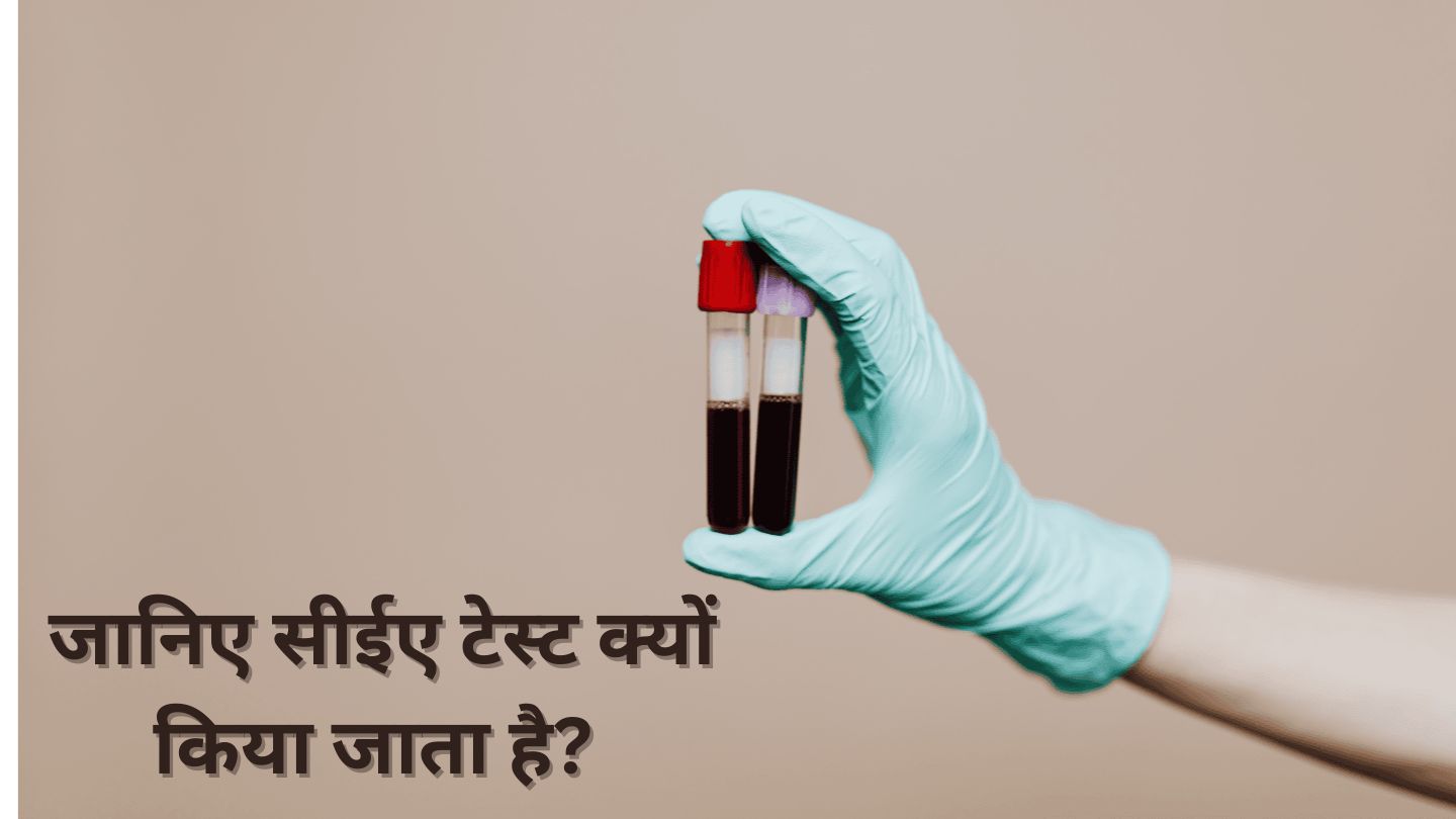 CEA Test in Hindi