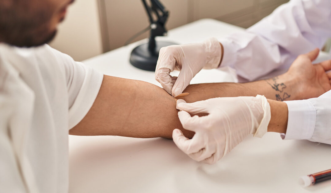 Free Testosterone Test