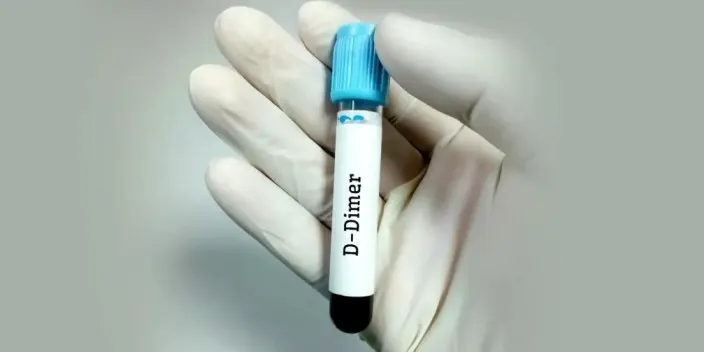d dimer test in hindi 