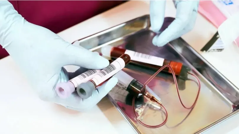 hiv western blot test in hindi 