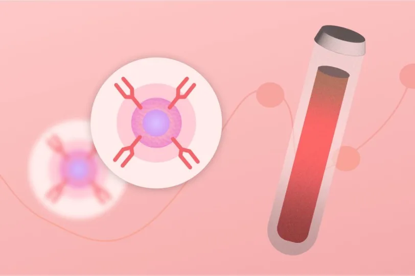 what is shbg test and why it is done 