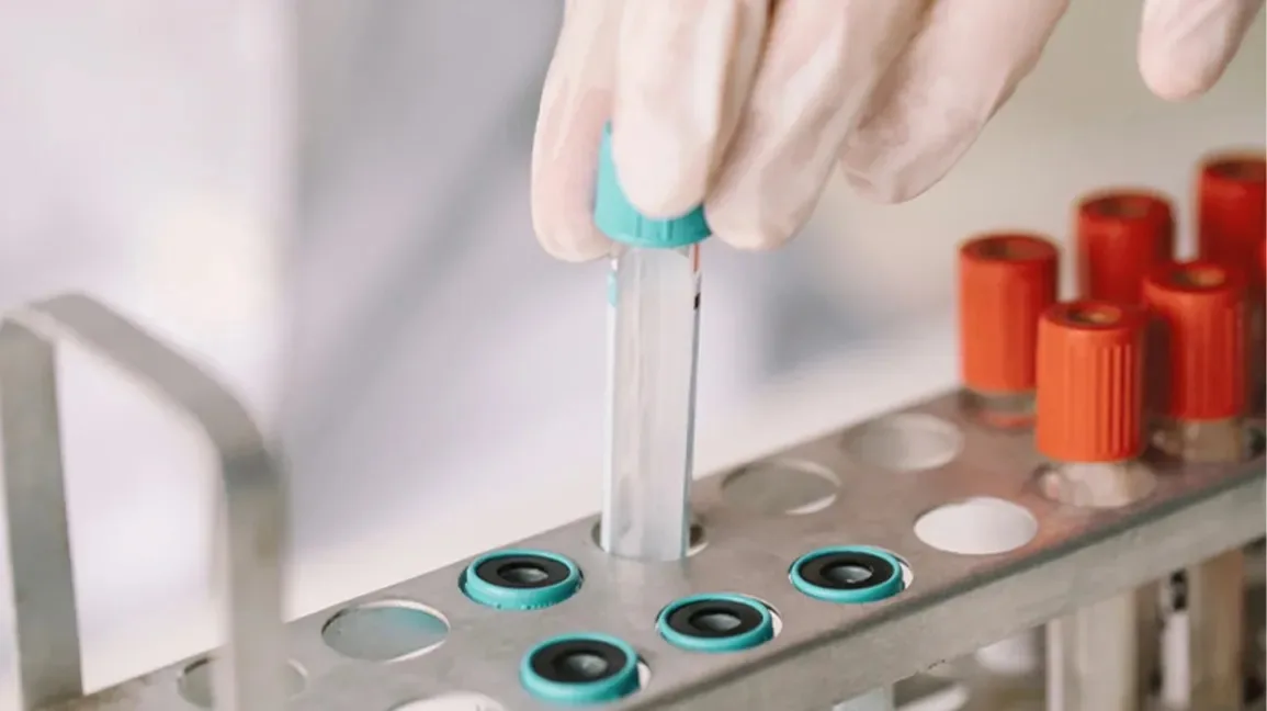 estradiol test in hindi 
