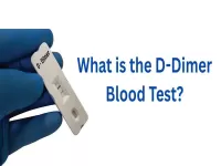 overview of d dimer blood test 