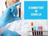 overview of d dimer blood test 