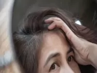 causes of premature greying of hair and treatment 