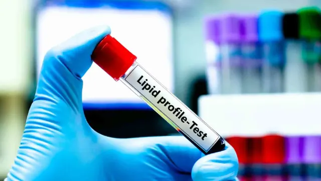 lipid profile test in hindi