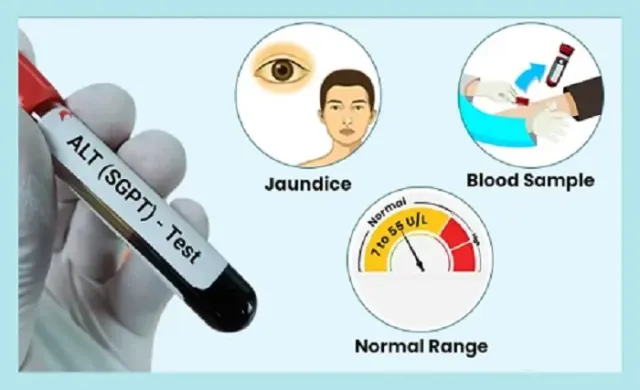 What is SGPT Test Normal Ranges
