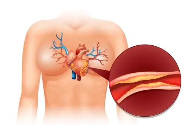 cholesterol in hindi