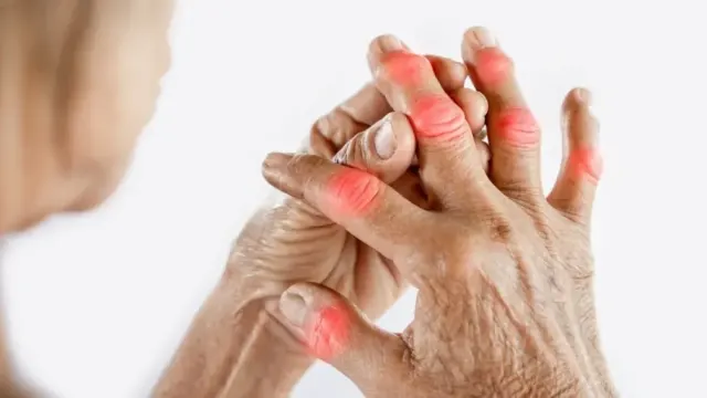what is rheumatoid arthritis and its effects