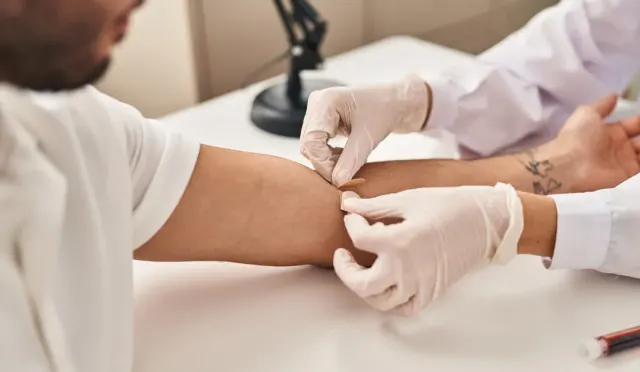 Free Testosterone Test