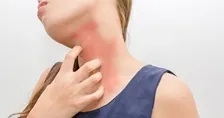 Allergy Test Packages in Jaipur
