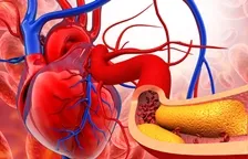Cholesterol Test Packages in Araria