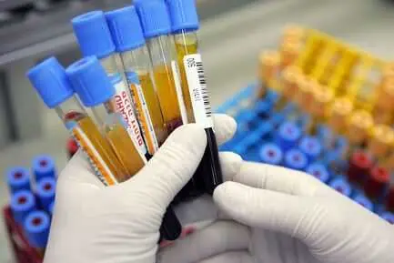 FREE TESTOSTERONE in saharsa health test