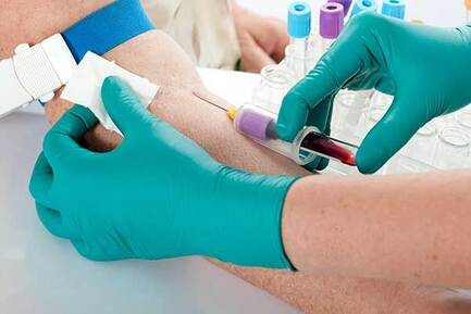 Filaria Antigen Rapid Test