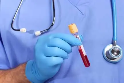HEMOGLOBIN available in nellore health test