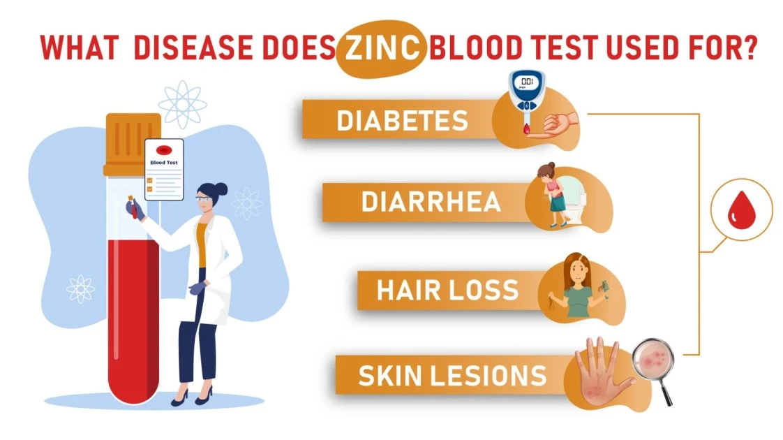Book Zinc Blood Test at Affordable Price Home
