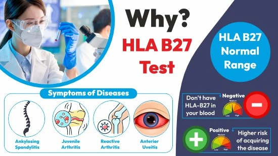 ranges of hla b27 test