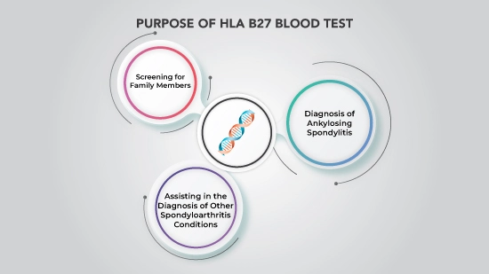 purpose of hla b27 test