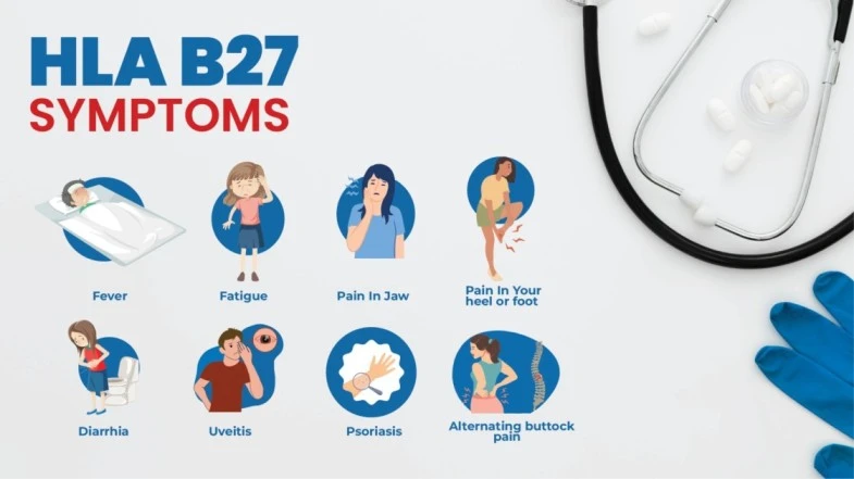 symptoms of hla b27