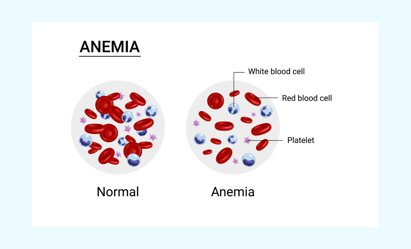 mchc symptoms in hindi
