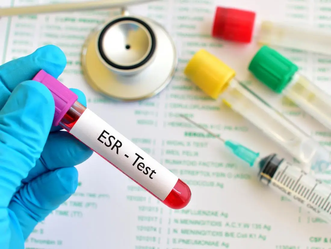 Erythrocyte Sedimentation Rate (ESR)