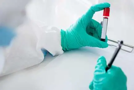 LDL CHOLESTEROL - DIRECT in goa health test