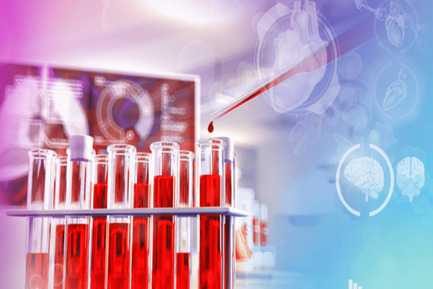 Anti Chlamydia Antibody Igm (ACA)