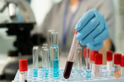 FEVER PANEL - BASIC (RAPID) in north dinajpur health test
