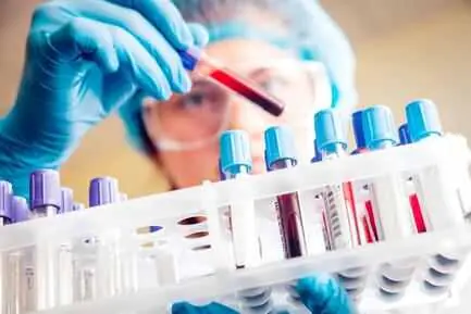 Executive Full Body Health Checkup 1+2 in sibsagar health test