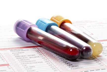 Angiotensin Converting Enzyme (ACE)