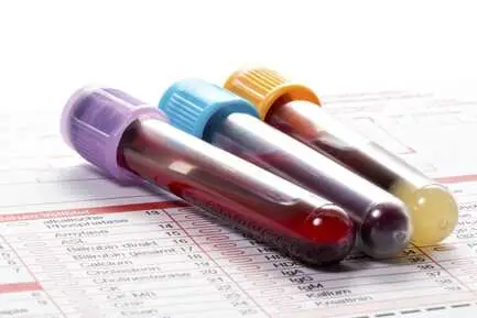 AAROGYAM FEMALE in bhojpur health test