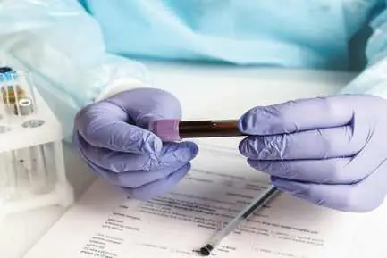 HEPATITIS E VIRUS ANTIBODY IGM(HEVM) RAPID TEST in bhojpur health test