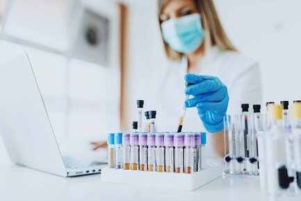 Hepatitis C Virus (HCV) Qualitative Pcr