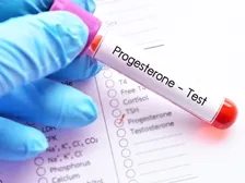 17 OH PROGESTERONE test 