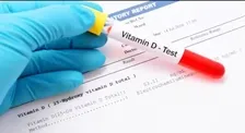 25-OH VITAMIN D (TOTAL)