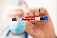 ANDROSTENEDIONE (A4)