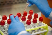 ANTI HEPATITIS A VIRUS (ANTI HAV) - IGM