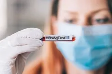 ANTI HEPATITIS B SURFACE ANTIGEN - TOTAL