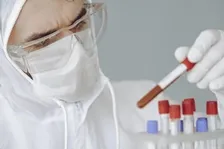 ANTI PHOSPHOLIPID ANTIBODY (APL) - IGG