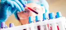 ANTI THYROGLOBULIN ANTIBODY (ATG)