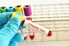 C PEPTIDE Test