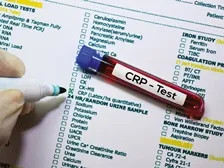 C-REACTIVE PROTEIN (CRP)