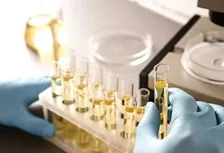 COMPLETE URINE ANALYSIS