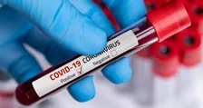 COVID ANTIBODIES-TOTAL (CLIA)