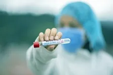 COVID ANTIBODY IGG (QUANTITATIVE) Test