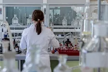 CYTOMEGALO VIRUS (CMV) - IgM