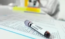 HEMOGLOBIN VARIANT ANALYSIS - HPLC