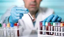 Complete Blood Count (CBC) Test - Hemogram - 6 Part (DIFF)