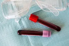 HEPATITIS B ENVELOPE ANTIGEN (HBEAG)