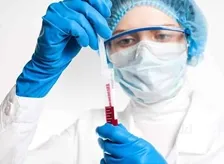 IMMUNOGLOBULIN A (IGA)